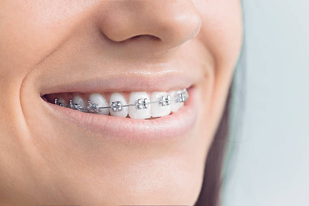 Best Wisdom Tooth Removal  in Boulder Hl, IL